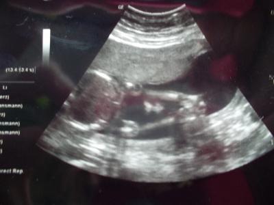 Bild zu Gestern FA Termin + 85% Outing... - Forum für Mai - Mamis