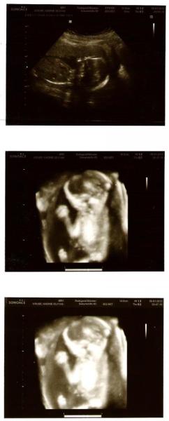 Bild zu Zurück vom FA... :-) - Forum für Mai - Mamis