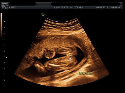 Bild zu Hier mal ein Outingbild von meinem Mädchen :) - Forum für Mai - Mamis