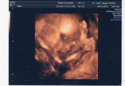 Bild zu Zurück vom FA - Forum für Mai - Mamis