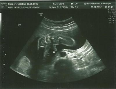 Bild zu Zurück von frauenarzt - Forum für Mai - Mamis