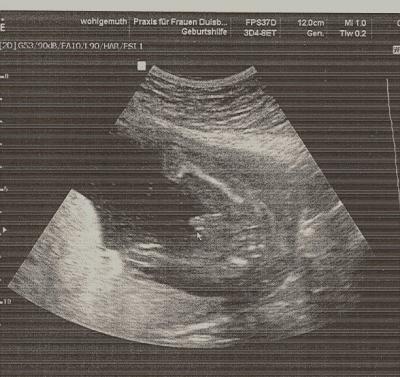 Bild zu Baby Foto - Forum für Mai - Mamis