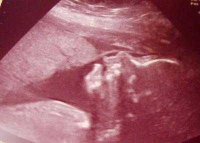 Bild zu War heut zum Baby TV! ;O)))) - Forum für Mai - Mamis