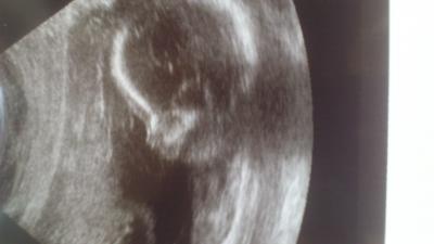 Bild zu Komme gerade vom Ultraschall - Forum für Mai - Mamis