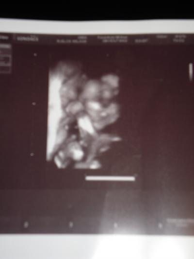 Bild zu US - Forum für Mai - Mamis