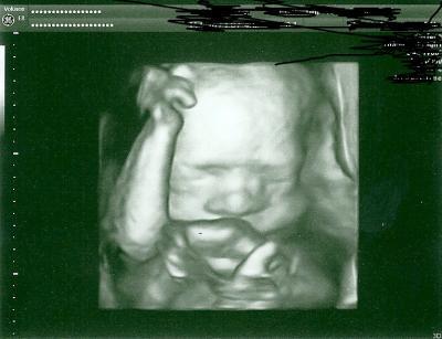 Bild zu Hier noch mal... - Forum für Mai - Mamis