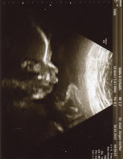 Bild zu Zurück vom FA - Forum für Mai - Mamis