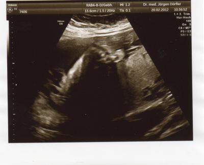 Bild zu Zurück vom FA - Forum für Mai - Mamis