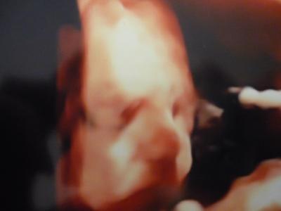 Bild zu US Bild aus der 22 SSWoche - Forum für Mai - Mamis