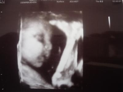 Bild zu FA-Besuch - Forum für Mai - Mamis