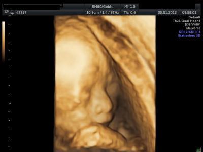 Bild zu Hier auch mal ein Bild von unserer Maus allerdings aus der 21.ssw - Forum für Mai - Mamis