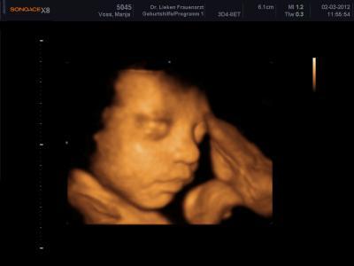 Bild zu 3D..ich konnte es nicht lassen.. - Forum für Mai - Mamis