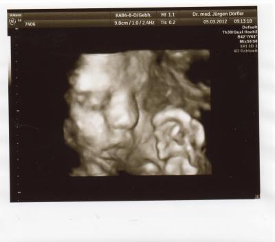 Bild zu Zurück vom FA - Forum für Mai - Mamis