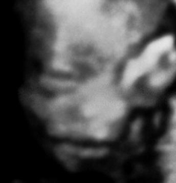 Bild zu Neues Bild von Josefin - Noch 47 Tage bis zum ET :-) - Forum für Mai - Mamis