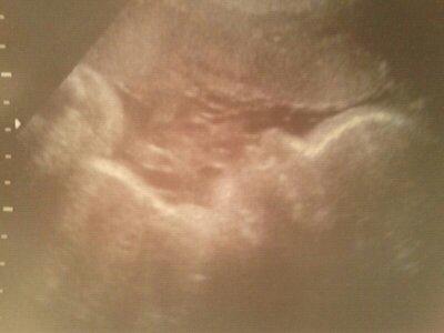 Bild zu Zeigt her eure letzten Ultraschallbilder von euren Babys!! - Forum für Mai - Mamis