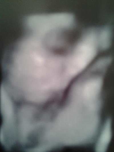 Bild zu Bild.... - Forum für Mai - Mamis