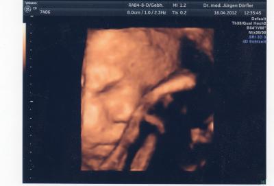 Bild zu Zurück vom FA - Forum für Mai - Mamis