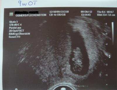 Bild zu Gestern endlich wieder Vorsorge gehabt :-) - Forum für Mai - Mamis