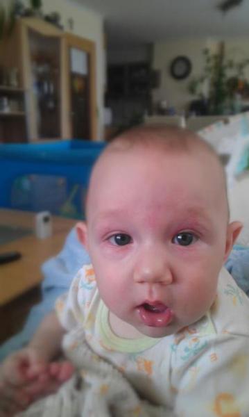 Bild zu