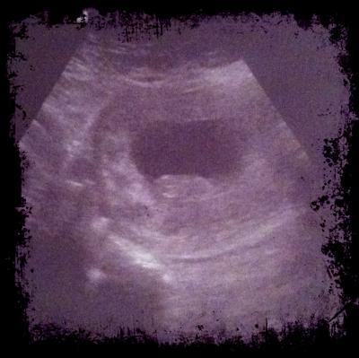 Bild zu Wieder da vom FA :) - Forum für Mai - Mamis