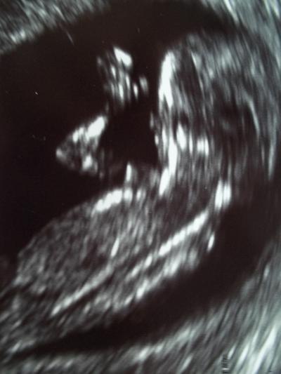 Bild zu Darf ich vorstellen... mein FA Bericht... :))))))))) Ein Wink Bild für euch alle - Forum für Mai - Mamis