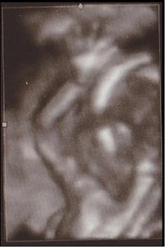 Bild zu 3D Foto - Forum für Mai - Mamis
