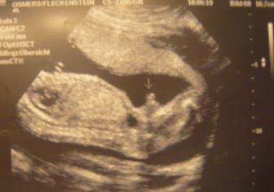 Bild zu Waren heut bei der Feindiagnostik :-) schaut euch das mal an.. - Forum für Mai - Mamis