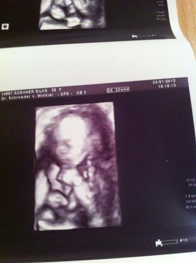 Bild zu Gestern beim Frauenarzt !!! - Forum für Mai - Mamis