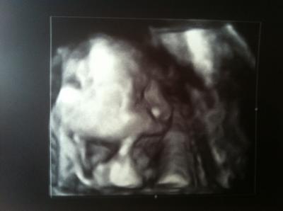 Bild zu Bericht Feindiagnostik:-) - Forum für Mai - Mamis