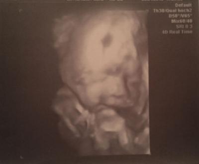 Bild zu Zurück vom 3D US :-D - Forum für Mai - Mamis