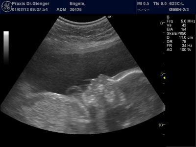 Bild zu Heute Vu und Foto - Forum für Mai - Mamis