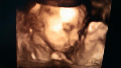 Bild zu Wieder da vom 3D US :-) + Bild - Forum für Mai - Mamis