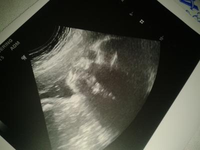 Bild zu Zurück vom FA + Bild - Forum für Mai - Mamis