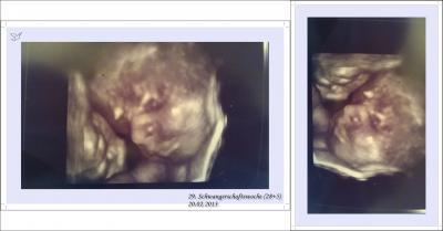 Bild zu Mein letzter Termin + Foto: - Forum für Mai - Mamis