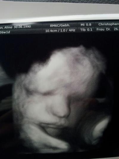 Bild zu kh bericht+bild - Forum für Mai - Mamis