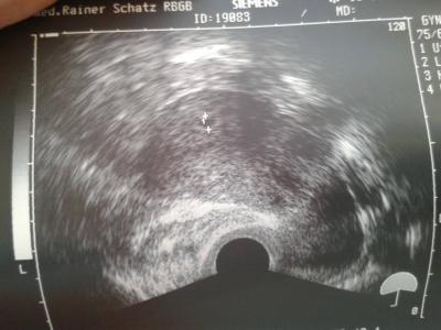 Bild zu Bin dann auch mal dabei :) - Forum für Mai - Mamis