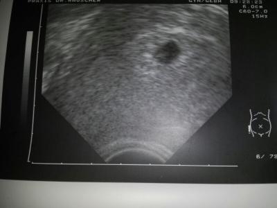 Bild zu Zurück vom Doc:) - Forum für Mai - Mamis
