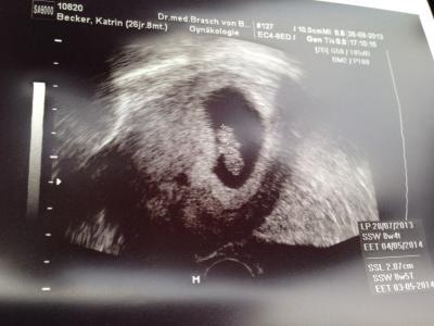 Bild zu Zurück vom FA - Forum für Mai - Mamis