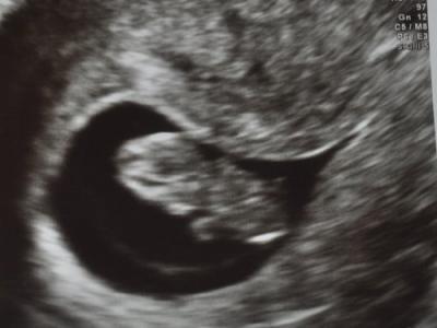 Bild zu Gestern beim FA :) - zum ersten Mal! - laenger - Forum für Mai - Mamis