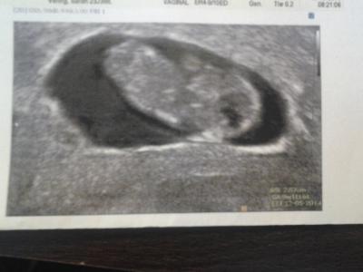 Bild zu Schon heute beim Arzt gewesen ... - Forum für Mai - Mamis