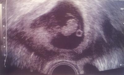 Bild zu Mein FA-Termin (etwas verspätet) - Forum für Mai - Mamis