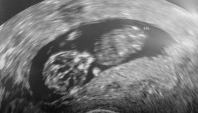 Bild zu Zusammenfassung FA-Termine - Forum für Mai - Mamis