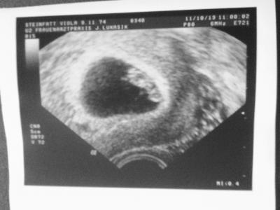 Bild zu Ist noch ein Plätzchen frei ? - Forum für Mai - Mamis