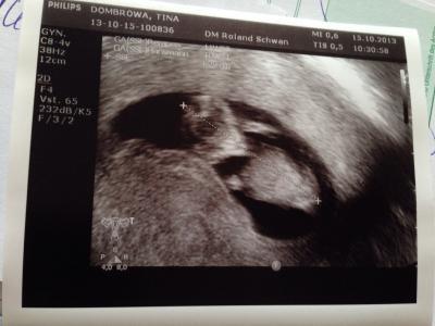 Bild zu FA gestern - Forum für Mai - Mamis