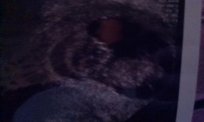 Bild zu FA Bericht - Forum für Mai - Mamis