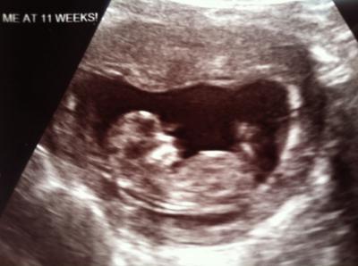 Bild zu Kleiner Schockmoment beim FA - Forum für Mai - Mamis