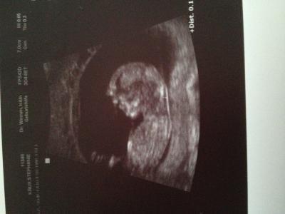 Bild zu Gestern ntm alles gut - Forum für Mai - Mamis