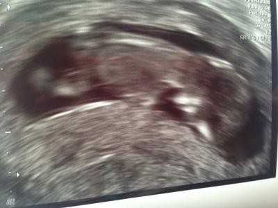 Bild zu Zurück vom FA - Forum für Mai - Mamis