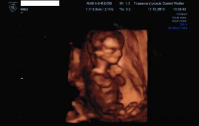 Bild zu Mein 3D-Bildchen bei 12+0 :) - Forum für Mai - Mamis