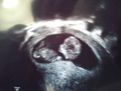 Bild zu Zurück vom FA - Forum für Mai - Mamis